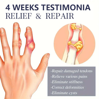 Bee Venom Joint Cream - Hypoallergenic and Soothing Moisturizing Lotion with a Light Fragrance for All Skin Types